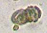 Photo of Calicium trabinellum spore