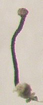 Photo of Chaenotheca grita apothecium