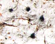 Close-up photo of fungus Julella fallaciosa