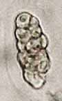 Microphotograph of spore of fungus Julella fallaciosa