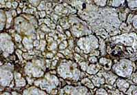 Photo of lichen Pertusaria alpina
