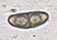 Photo through microscope of Rinodina subminuta spore
