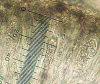 Photo through a microscope of Strangospora moriformis spore sacs